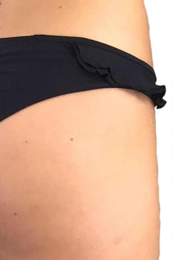 Ruffle Scrunch Black Bottom side